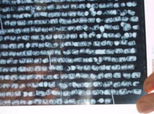 X-ray of bee cocoons done at the Brooks Cocoon Testing Centre